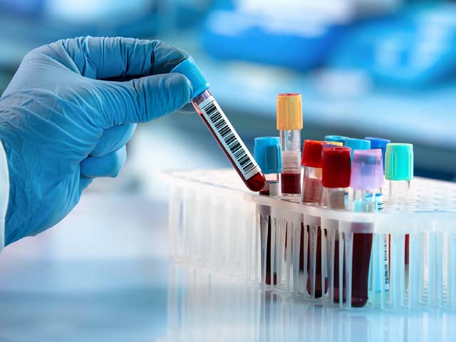 Test sierologici per i residenti di Buccinasco